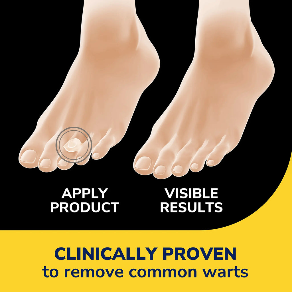 Clear Away® Wart Removers Seal & Heal Bandage with Hydrogel Technology