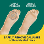 Extra Thick Callus Removers
