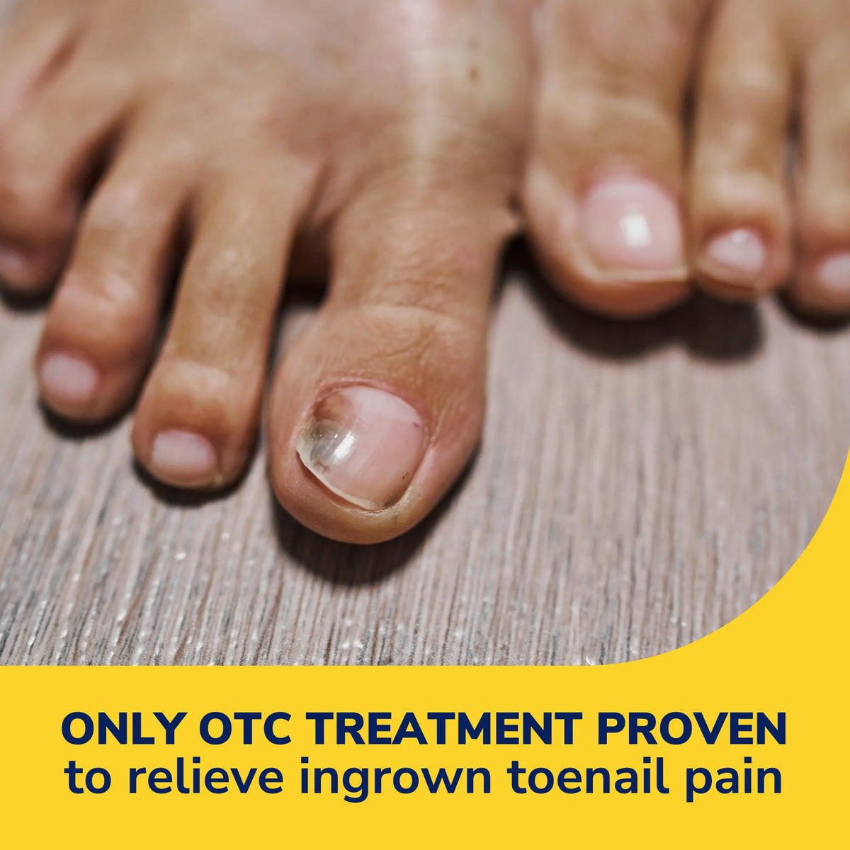 Ingrown Toenail Pain Reliever & Trimming Kit