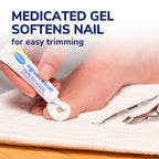 Ingrown Toenail Pain Reliever & Trimming Kit