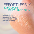 Callus Remover Electronic Foot File